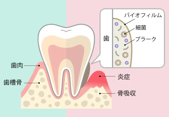 拡大イメージ