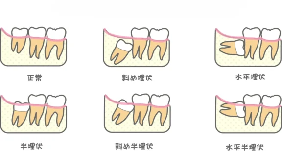 拡大イメージ