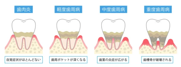 拡大イメージ