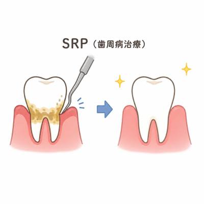 SRPって何をするの？