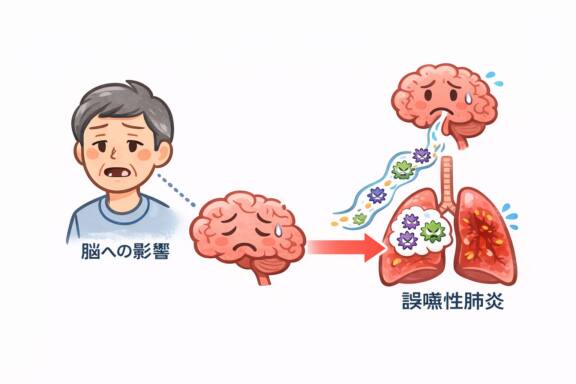 【第3回】歯周病と脳・肺の病気