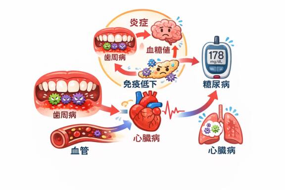 【第2回】歯周病と糖尿病・心臓病の関係