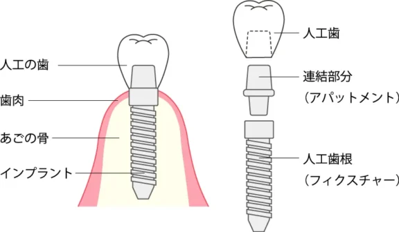 拡大イメージ